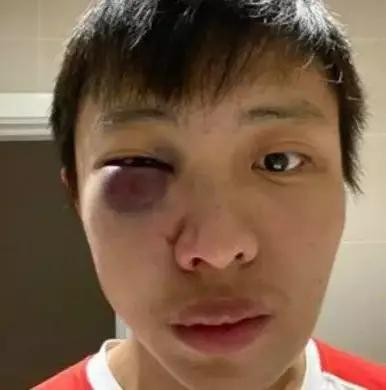 新加坡留学生在墨尔本街头遭暴打，竟因新冠肺炎歧视！-异乡好居